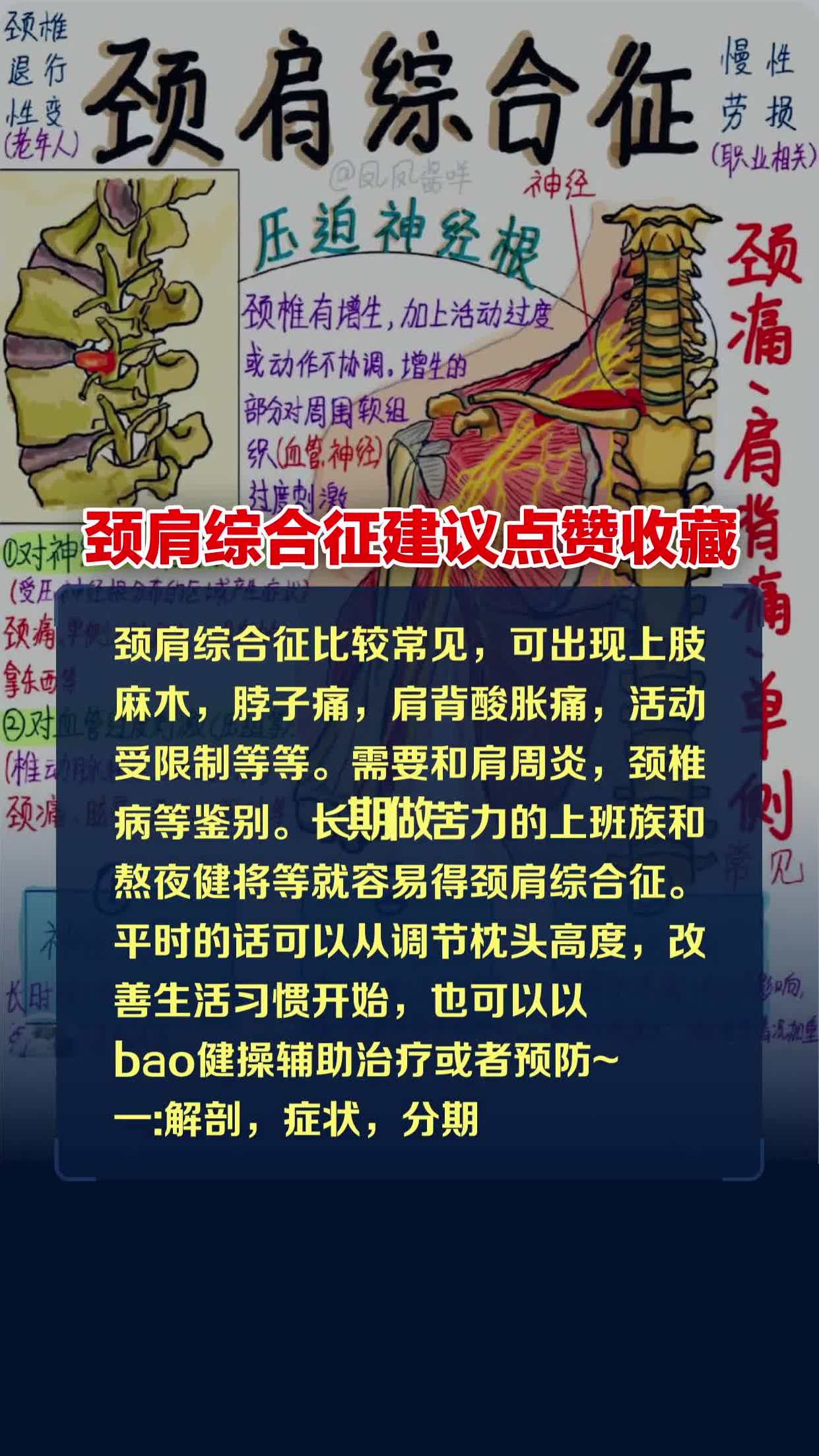 颈肩综合征建议点赞收藏