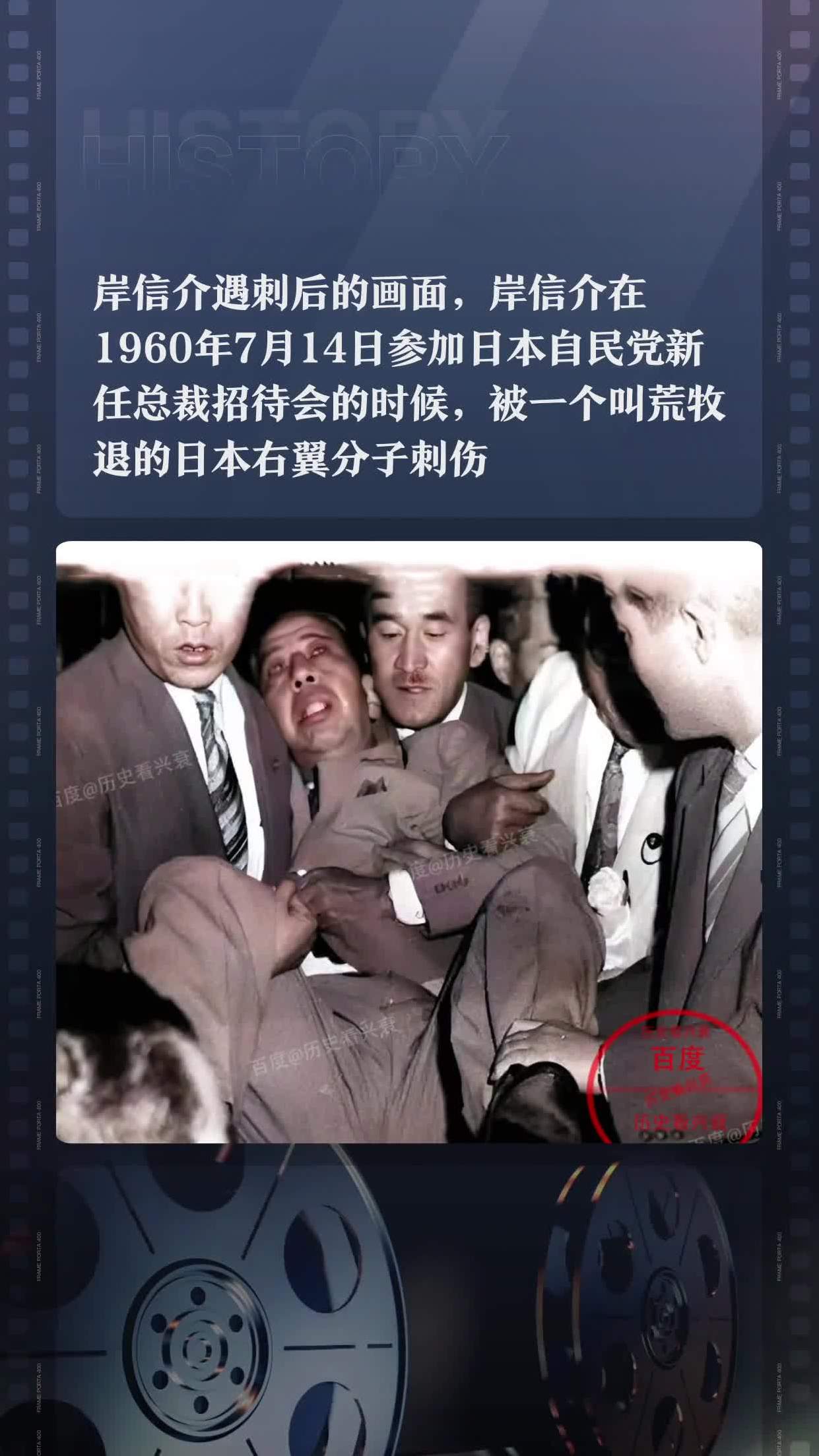 岸信介遇刺后的画面,岸信介在1960年7月14日参加日本自民党新任总裁
