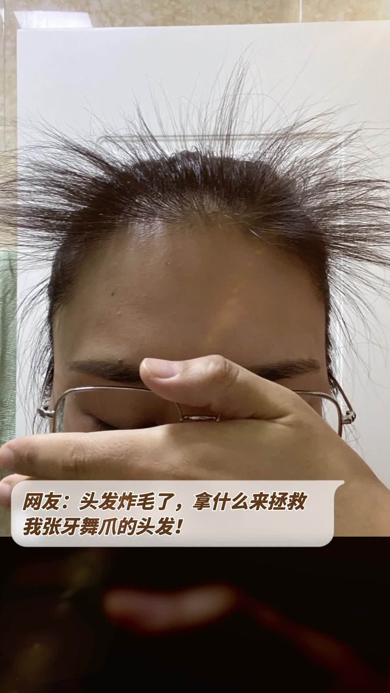 网友:头发炸毛了,拿什么来拯救我张牙舞爪的头发!
