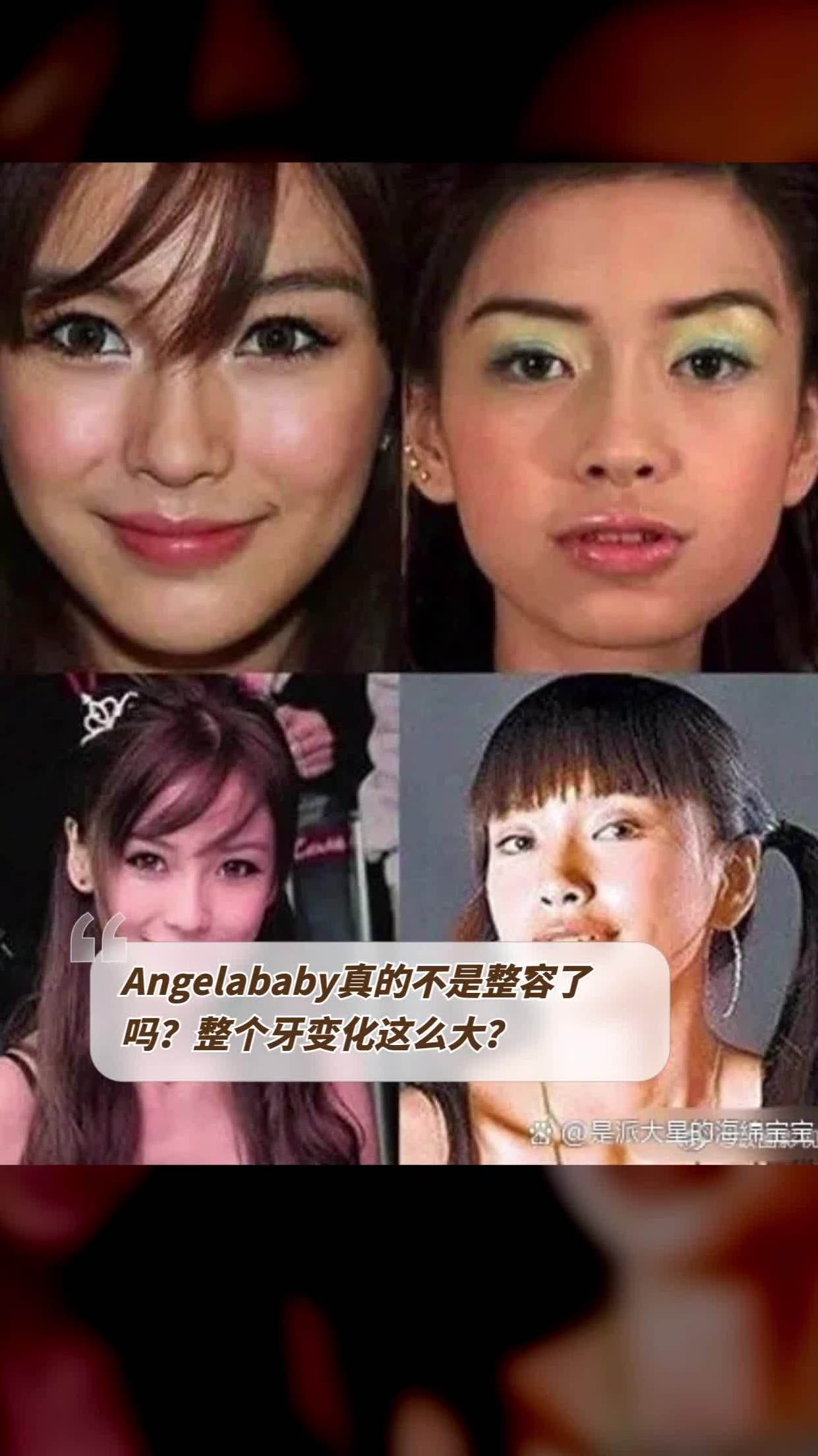 angel baby整容前图片图片